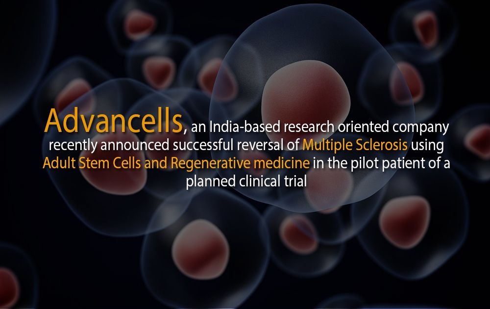“ADVANCELLS” announces successful revfersal of multiple sclerosis through adult stem cell therapy