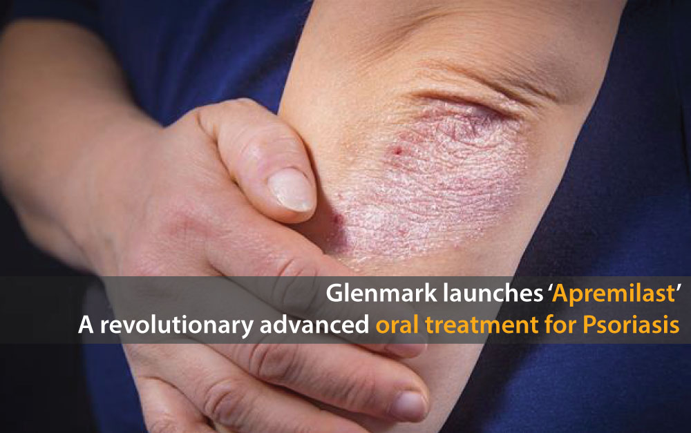 Glenmark Launches Apremilast