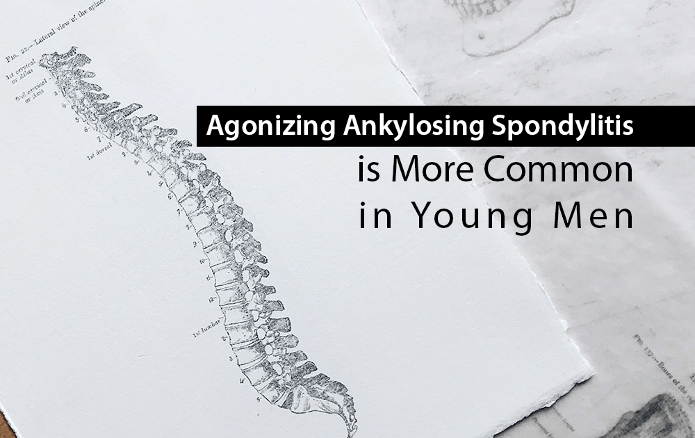 Agonizing Ankylosing Spondylitis is More Common in Young Men
