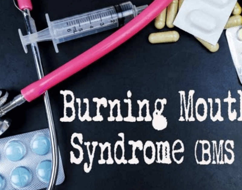 Burning mouth syndrome featured image for wordpress and facebook