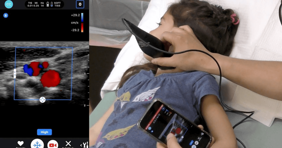 Portable ultrasound system – ‘BUTTERFLY IQ’