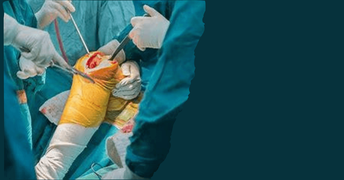 Handling of the fragile patient in arthroplasty