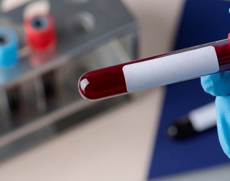 The Evolving Landscape of Blood Transfusion